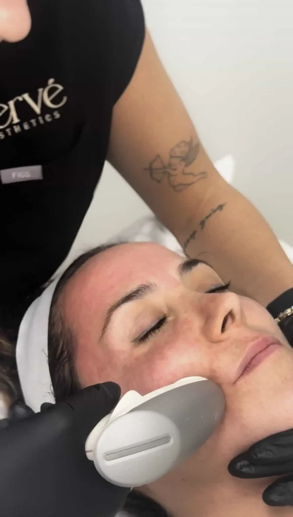 Skin Rejuvenation at Verve Aesthetics in North Miami FL | Portfolio